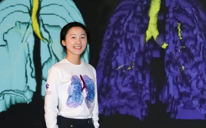 Master's student Helen He is getting an interdisciplinary experience that combines artificial intelligence, advanced lung imaging, patient interaction and data analysis in the API Lab at Western’s Robarts Research Institute. Her work is helping researchers move toward more personalized care for patients with asthma. (Colleen MacDonald/Western News)