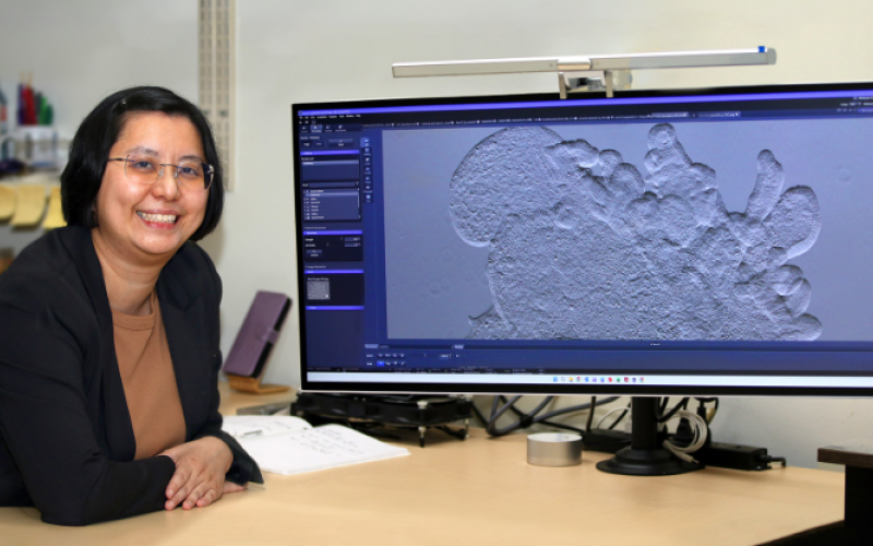 Schulich Medicine & Dentistry professor Van Lu presents an image of an organoid – a lab-grown cluster of cells that acts like a simplified human organ – used in her research on the gastrointestinal tract. Organoid research is accelerating at Western with a grant from the Canada Foundation for Innovation that will bring a state-of-the-art 4D imaging system to campus, one of eight Western projects receiving infrastructure funding. (Colleen MacDonald/Western News)