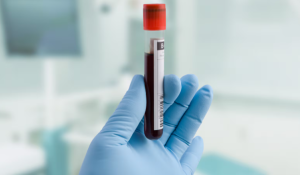 Canadian first: One-time gene therapy given to London, Ont., hemophilia B patient